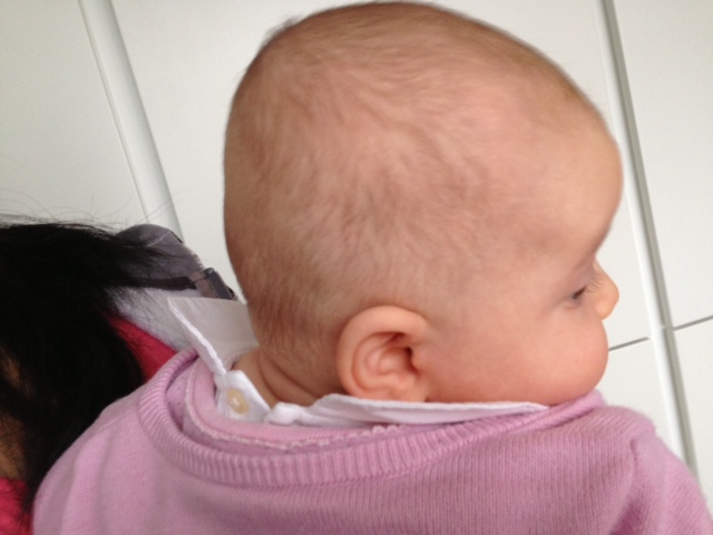 Затылок новорожденного. Долихоцефалическая форма головы у ребенка. Долихоцефалическая форма головы у ребенка в 4 месяца. Уплощение затылка у ребенка.